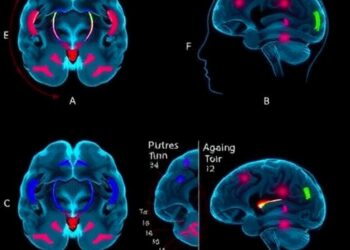 Ageing Impacts Implicit, Explicit Sensorimotor Learning Differently — Psychology & Psychiatry