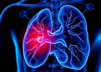 Breakthrough Molecular Marker Promises Enhanced Prostate Cancer Therapy — Cancer