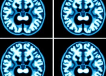 CLEAR-DESS MRI Boosts Parkinson’s Diagnosis at 7T — Medicine