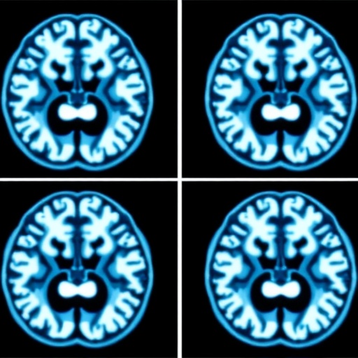 CLEAR-DESS MRI Boosts Parkinson’s Diagnosis at 7T — Medicine