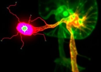 Catecholaminergic Neurons Enhance Keloid Fibroblast Bone Growth — Medicine