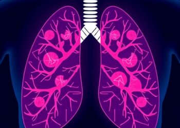 Comparative Study of Leading Targeted Therapies for ALK+ Lung Cancer Promises Enhanced Treatment Strategies — Cancer