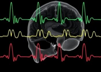 Continuous EEG Reveals Seizures After Neonatal Heart Surgery — Technology and Engineering