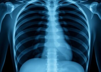 DeepSeek AI Transforms Automated Chest X-Ray Analysis — Medicine