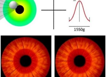 Early Detection of Keratoconus Enhanced by Light Polarization and AI — Technology and Engineering