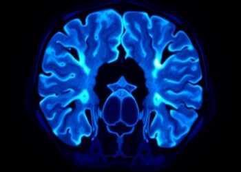 Enhancing Low-Dose CT Scans with Interpretable Multi-Gaussian Cluster Variance Reduction — Technology and Engineering