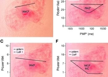 Epidermal MHC-II Drives NK Cell Attack in Psoriasis — Cancer