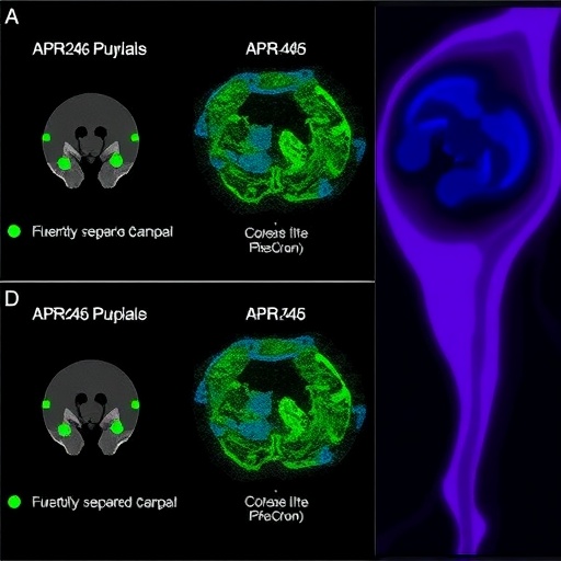 Evaluating APR-246 Response in Ovarian Cancer Mutants — Medicine