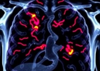 Fusion-Positive Rhabdomyosarcoma Oncofusions Share Interactome — Medicine