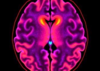 GABA Dysfunction in Parkinson’s Revealed by MRI — Medicine