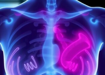Gene Testing Safely Spares Many Breast Cancer Patients from Chemotherapy — Cancer