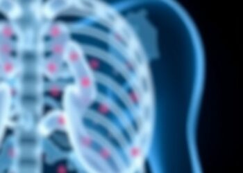 How Ceramide Lipid Metabolism Influences Prostate Cancer Drug Response — Cancer