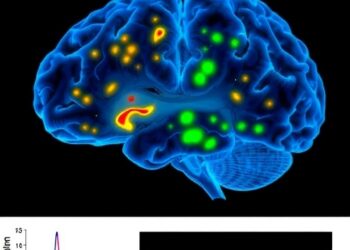 Human Oligodendrocyte Polarization Post-Severe Brain Injury — Medicine