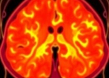 Innovative AI Technique Predicts Radiation Dosage Prior to Treatment in Advanced Prostate Cancer — Medicine