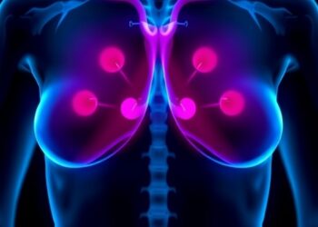 Innovative Therapy Lowers Breast Density with Minimal Side Effects — Cancer