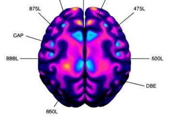 Lipid Profiles in Amygdala: Sporadic vs GBA Parkinson’s — Medicine