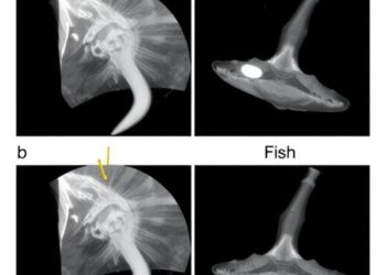 Minimally Invasive Ultrasound-Guided Endoscopic Retrieval of Deeply Embedded Cervical Fish Bone Following Unsuccessful Open Surgery — Biology