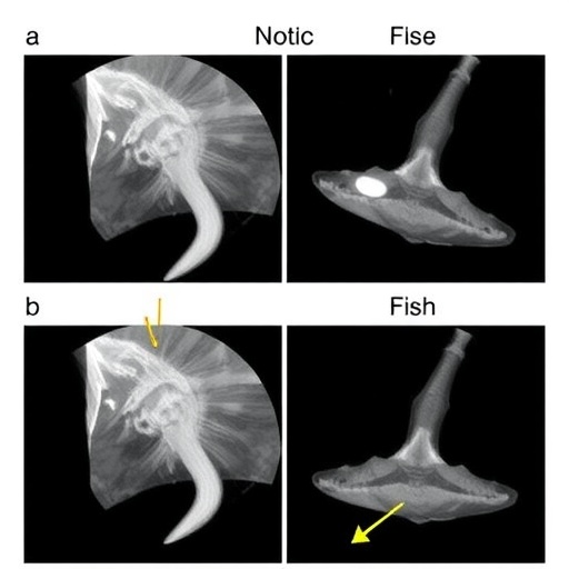 Minimally Invasive Ultrasound-Guided Endoscopic Retrieval of Deeply Embedded Cervical Fish Bone Following Unsuccessful Open Surgery — Biology