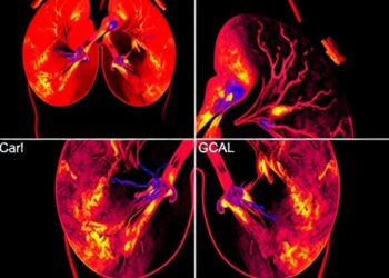 Multi-Modal AI Advances Breast Cancer Prognosis — Medicine