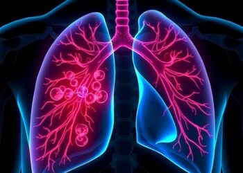 Nervous System Aids Lung Cancer in Escaping Immune Detection, Study Finds — Cancer