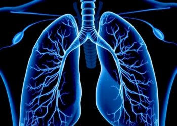 New Alliance Launches Trial to Explore Targeted Radiation Therapy Following Lung Cancer Surgery — Cancer
