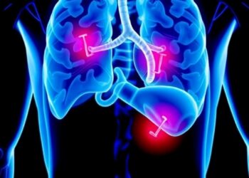 New Clinical Trial Launches to Determine if Combining Chemotherapy with Hormone Therapy Enhances Survival in Metastatic Prostate Cancer — Cancer