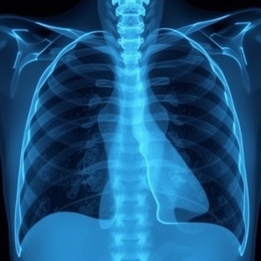 New Study Finds Simple X-Ray Metric Predicts Survival in Lung Cancer Surgery Patients — Cancer