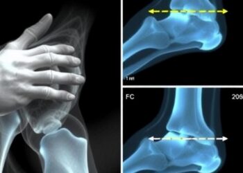 New Study Reveals Minimal Joint Damage in Astronauts Following Short Space Missions, Showcasing Potential of Ultrasound Monitoring — Space