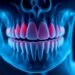 Periodontitis Drives Muscle Atrophy via Activin A — Medicine