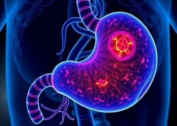 RAS inhibitor daraxonrasib shows promising early anti-tumor effects in pancreatic cancer — Cancer