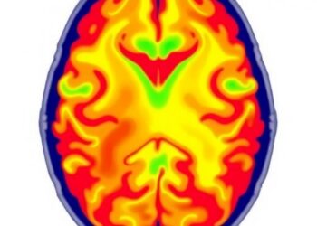 Resting-State fMRI Reveals How Visual Status Influences Walking-Related Brain Activity in Healthy Young Adults — Technology and Engineering