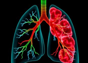 Scientists Identify Biomarker Linked to Chemotherapy Resistance in Relapsed Lung Cancer — Cancer