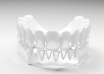 Simple Adjustment in 3D Printing Enhances Fit of Dental Crowns — Chemistry