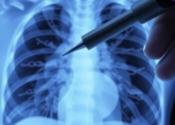 Study Finds Lung Biopsy Cryoprobe Significantly Improves Diagnostic Accuracy Compared to Standard Forceps — Cancer