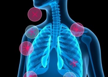 Study Reveals Multiple Health Conditions Common Among Severe Asthma Patients — Technology and Engineering