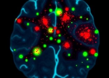TDP43 Mislocalization Drives Disc Degeneration and Aging — Cancer