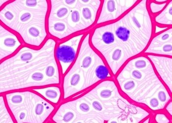 Targeting S100A4–TLR4–TGF-β Axis in Diabetic Dupuytren’s — Medicine