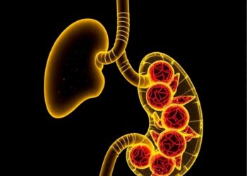 Toxicology Links Cadmium Exposure to Pancreatic Cancer — Medicine