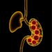 Toxicology Links Cadmium Exposure to Pancreatic Cancer — Medicine