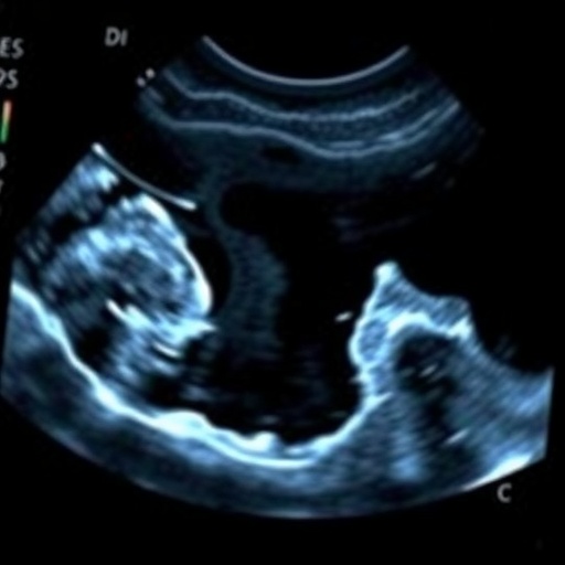 Ultrasound Measures Muscle Size in Preterm Infants — Medicine