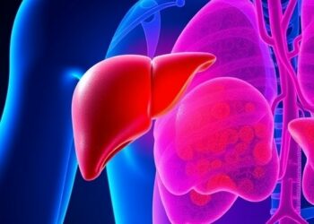 Understanding Cirrhosis, Portal Hypertension, and Liver Cancer — Cancer