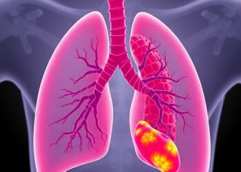 YWHAZ Drives Pulmonary Artery Remodelling via HIF1A — Medicine