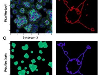 microRNA-25 fuels immune therapy resistance via Syndecan-3 — Medicine
