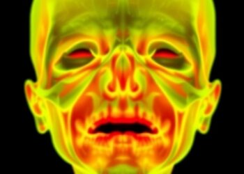 AI Detects Fetal Orofacial Clefts, Boosts Education — Medicine