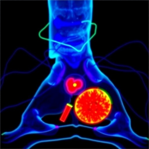 Active β-Catenin Drives Aggressiveness in Pediatric Osteosarcoma, Study Finds — Medicine