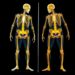 Allergic Diseases Linked to Osteoporosis, Fractures in Elderly — Medicine