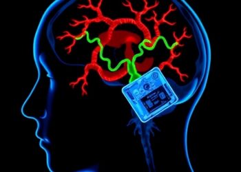 Antler Stem Cells Relieve Cerebral Ischemic Injury — Medicine