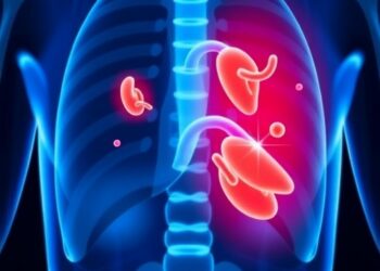 Can Aspirin Reveal Hidden Cases of Asymptomatic Bladder Cancer? — Medicine
