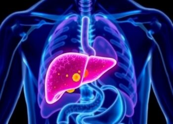 Can Immunotherapy Increase Liver Cancer Patients’ Eligibility for Transplantation? — Cancer