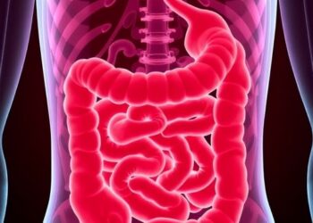 Delays in Treatment Impact Outcomes for Early-Onset Colorectal Cancer — Cancer